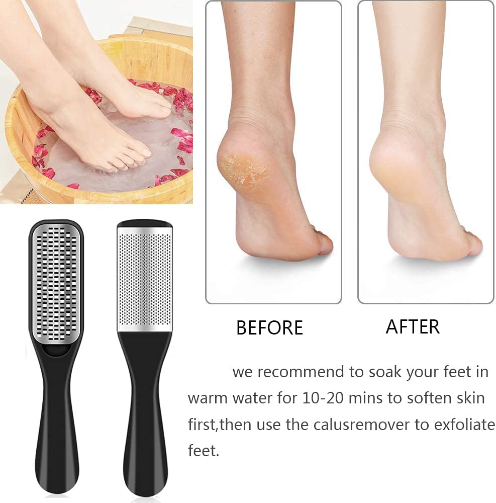 36-in-1 Pedicure Kit | Professional Foot Care Set with Rasp, Clippers & Files | At-Home or Travel Spa Tool Kit